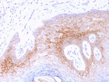 IHC testing of FFPE human skin with Desmocollin 2/3 antibody (clone 7G6). Required HIER: boil tissue sections in 10mM Tris with 1mM EDTA, pH 9, for 10-20 min.~