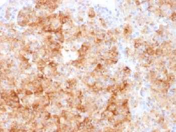 IHC analysis of FFPE human parathyroid gland stained with Chromogranin A antibody. Required HIER: steam sections in pH6 citrate buffer for 10-20 min.~