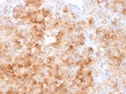 IHC analysis of FFPE human parathyroid gland stained with Chromogranin A antibody. Required HIER: steam sections in pH6 citrate buffer for 10-20 min.