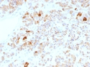 IHC testing of FFPE human pituitary gland stained with Luteinizing Hormone alpha antibody (clone LHa/756). No HIER required.