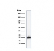 Western blot testing of human COLO-38 cell lysate with Melan-A antibody. Expected molecular weight ~20 kDa with possible doublet.