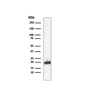 Western blot testing of human COLO-38 cell lysate with Melan-A antibody. Expected molecular weight ~20