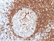 IHC testing of FFPE human tonsil tissue with CD79a antibody (clone HM57). Required HIER: boil tissue sections in pH 9 10mM Tris with 1mM EDTA for 10-20 min.