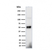 Western blot testing of human Raji cell lysate with CD79a antibody (clone HM57). Expected molecular weight: 25-47 kDa depending on glycosylation level.