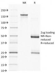 SDS-PAGE analysis of purified, BSA-free CD79a antibody (clone HM57) as confirmation of integrity and purity.