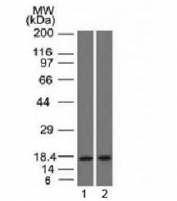 Western blot testing of human 1) pancreas and 2) HepG2 lysate with PIP antibody (clone PIP/1571). Expected molecular weight ~15 kDa.