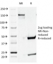 SDS-PAGE Analysis of Purified, BSA-Free CD44v4 Antibody (clone CD44v4/1219). Confirmation of Integrity and Purity of the Antibody.