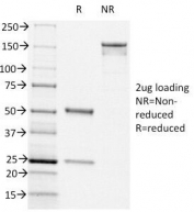 SDS-PAGE Analysis of Purified, BSA-Free CD44v6 Antibody (clone CD44v6/1246). Confirmation of Integrity and Purity of the Antibody.