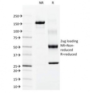 SDS-PAGE Analysis of Purified, BSA-Free Keratin 15 Antibody (clone LHK15). Confirmation of Integrity and Purity of the Antibody.