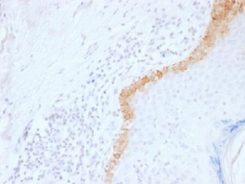 IHC testing of FFPE human skin with Keratin 15 antibody (clone LHK15). Required HIER: boil tissue sections in 10mM citrate buffer, pH 6, for 10-20 min.~