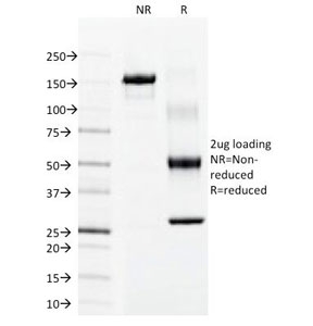 SDS-PAGE Analysis of Purified, BSA-Free Keratin 15 Antibody (clone LHK15). Confirmat
