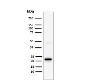 Western blot testing of human Jurkat cell lysate with CD3e antibody (clone C3e/1308). Predicted molecular weight ~23 kDa.~