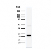 Western blot testing of human Jurkat cell lysate with CD3e antibody (clone C3e/1308). Predicted molecular weight ~23 kDa.