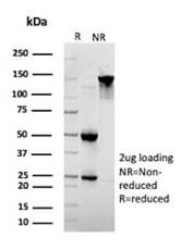 SDS-PAGE analysis of purified, BSA-free Desmoglein 2 antibody (clone 8E5) as confirmation of integrity and purity.