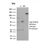 SDS-PAGE analysis of purified, BSA-free Desmoglein 2 antibody (clone 8E5) as confirmation of integrity and purity.