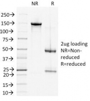 SDS-PAGE Analysis of Purified, BSA-Free DSG2 Antibody (clone 6D8). Confirmation of Integrity and Purity of the Antibody.