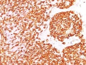 IHC test of FFPE human tonsil probed with CD45 antibody (clone PTPRC/1460). Required HIER: boil tissue sections in 10mM citrate buffer, pH 6, for 10-20 min.