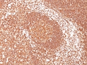 IHC staining of FFPE human tonsil with CD45 antibody (clone PTPRC/1461). HIER: boil tissue sections in pH 9 10mM Tris with 1mM EDTA for 20 min and allow to cool before testing.