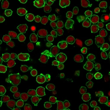 Immunofluorescent staining of PFA-fixed human Jurkat cells with CD45 antibody (clone PTPRC/1461, green) and Reddot nuclear stain (red).~
