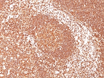 IHC staining of FFPE human tonsil with CD45 antibody (clone PTPRC/1461). HIER: boil tissue sections