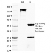 SDS-PAGE Analysis of Purified, BSA-Free FOXA1 Antibody (clone FOXA1/1514). Confirmation of Integrity and Purity of the Antibody.
