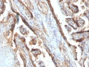 IHC testing of FFPE human placenta with Galectin 13 antibody (clone PP13/1161). Required HIER: boil tissue sections in 10mM Tris with 1mM EDTA, pH 9 or 10mM Citrate buffer, pH 6, for 10-20.
