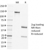 SDS-PAGE Analysis of Purified, BSA-Free Clathrin Heavy Chain Antibody (clone CLTC/1431). Confirmation of Integrity and Purity of the Antibody.