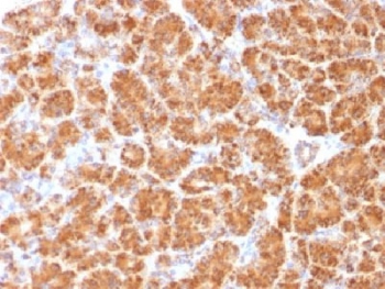 IHC testing of FFPE human pancreas with Clathrin Light Chain antibody (clone CLC/1421). Required HIER: boil tissue sections in 10mM Citrate buffer, pH 6.0, for 10-20 min.~