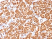 IHC testing of FFPE human pancreas with Clathrin Light Chain antibody (clone CLC/1421). Required HIER: boil tissue sections in 10mM Citrate buffer, pH 6.0, for 10-20 min.