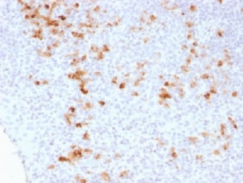 IHC testing of FFPE human tonsil stained with Kappa Light Chain antibody (clone KLC1278). Required HIER: boil tissue sections in 10mM Tris with 1mM EDTA, pH 9, for 10-20 min.~