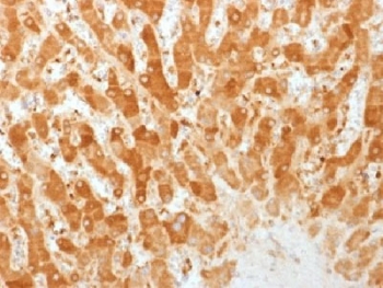 IHC testing of FFPE human liver with Connexin 32 antibody (clone GJB1/1753). Required HIER: boil tissue sections in 10mM citrate buffer, pH 6, for 10-20 min.~