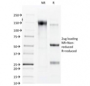 SDS-PAGE Analysis of Purified, BSA-Free Connexin 32 Antibody (clone R5.21C). Confirmation of Integrity and Purity of the Antibody.