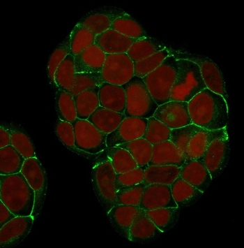 Immunofluorescent staining of human MCF7 cells with E-Cadherin antibody (clone SP