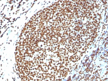 IHC testing of FFPE human tonsil and Histone H1 antibody. Required HIER: boil tissue sections in 10mM citrate buffer, pH 6,
