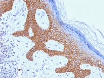 IHC testing of FFPE human skin with Desmoglein 3 antibody (clone DSG3/1535). Required HIER: boil tissue sections in 10mM citrate buffer, pH 6, for 10-20 min.~