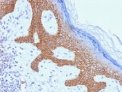 IHC testing of FFPE human skin with Desmoglein 3 antibody (clone DSG3/1535). Required HIER: boil tissue sections in 10mM citrate buffer, pH 6, for 10-20 min.