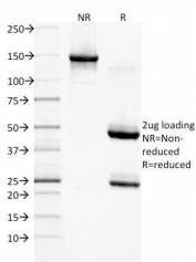 SDS-PAGE Analysis of Purified, BSA-Free EGF Receptor Antibody (clone GFR/1708). Confirmation of Integrity and Purity of the Antibody.