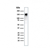 Western blot testing of human A431 cell lysate with EGF Receptor antibody. Expected molecular weight: 134-180 kDa depending on glycosylation level.