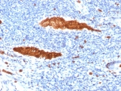 IHC testing of FFPE human tonsil tissue with Glycophorin A antibody (clone JC 159). Required HIER: boil tissue sections in pH 9 10mM Tris with 1mM EDTA for 10-20 min.