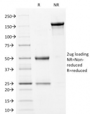 SDS-PAGE Analysis of Purified, BSA-Free Filaggrin Antibody (clone FLG/1561). Confirmation of Integrity and Purity of the Antibody.