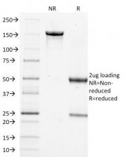 SDS-PAGE Analysis of Purified, BSA-Free Filaggrin Antibody (clone FLG/1562). Confirmation of Integrity and Purity of the Antibody.