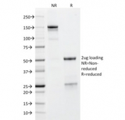 SDS-PAGE analysis of purified, BSA-free GP2 antibody (clone GP2/1712) as confirmation of integrity and purity.