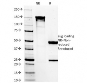 SDS-PAGE analysis of purified, BSA-free DOG1 antibody (clone DG1/1485) as confirmation of integrity and purity.