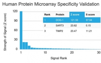 Analysis of HuProt(TM) microarray containing more than 19,