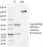 SDS-PAGE Analysis of Purified, BSA-Free FOXA1 Antibody (clone FOXA1/1515). Confirmation of Integrity and Purity of the Antibody.