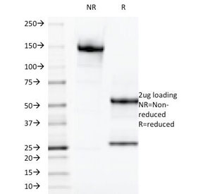 SDS-PAGE Analysis of Purified, BSA-Free LGALS13 An