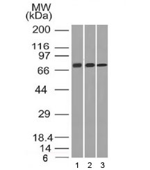 Western blot testing of human 1) HeLa, 2) A431 and 3) HL60 cell lysate with CD105 antibody (clone ENG/1326). Observed molecular weight: 70/90 kDa (monomer, unmodified/glycosylated); 140-180 kDa (dimer, unmodified/glycosylated).~