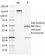 SDS-PAGE Analysis of Purified, BSA-Free Endoglin Antibody (clone ENG/1327). Confirmation of Integrity and Purity of the Antibody.