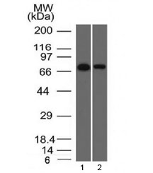 Western blot testing of human 1) HeLa and 2) A431 cell lysate with Endoglin antibody (clone ENG/1327). Observed molecular weight: 70/90 kDa (monomer, unmodified/glycosylated); 140-180 kDa (dimer, unmodified/glycosylated).~