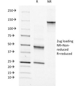SDS-PAGE Analysis of Purified, BSA-Free Moesin Antibody (clone MSN/491). Confirmation of Integrity and Purity of the Antibody.